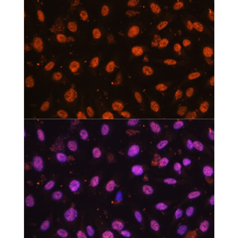 Immunofluorescence - Anti-ZEB1 Antibody (A88558) - Antibodies.com