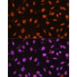 Immunofluorescence - Anti-ZEB1 Antibody (A88558) - Antibodies.com