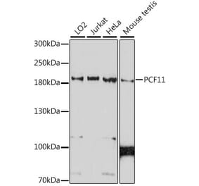 Western Blot - Anti-PCF11 Antibody (A88559) - Antibodies.com