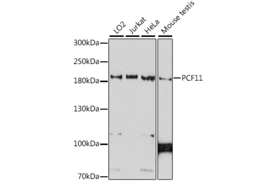Western Blot - Anti-PCF11 Antibody (A88559) - Antibodies.com