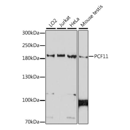 Western Blot - Anti-PCF11 Antibody (A88559) - Antibodies.com