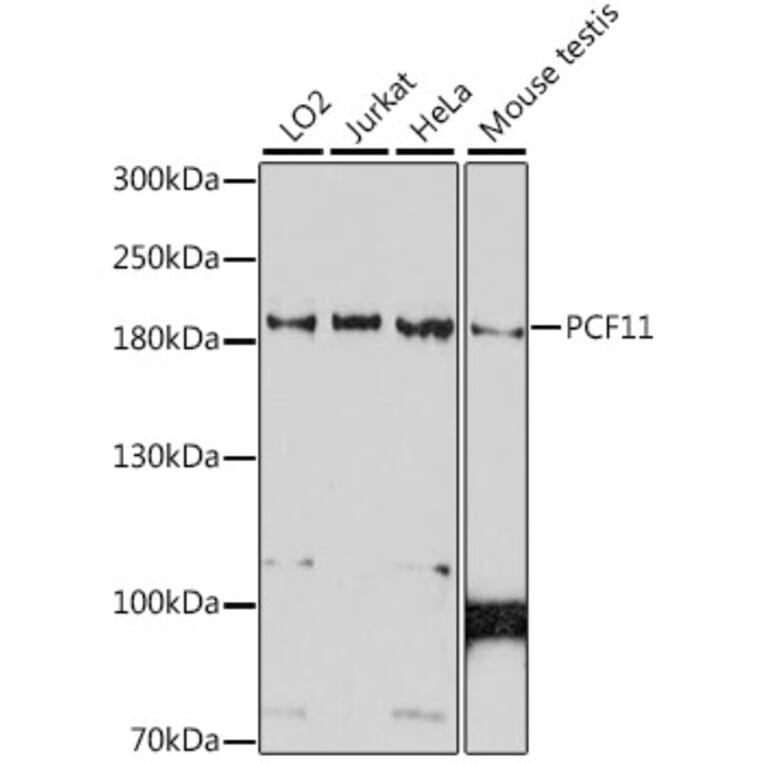 Western Blot - Anti-PCF11 Antibody (A88559) - Antibodies.com