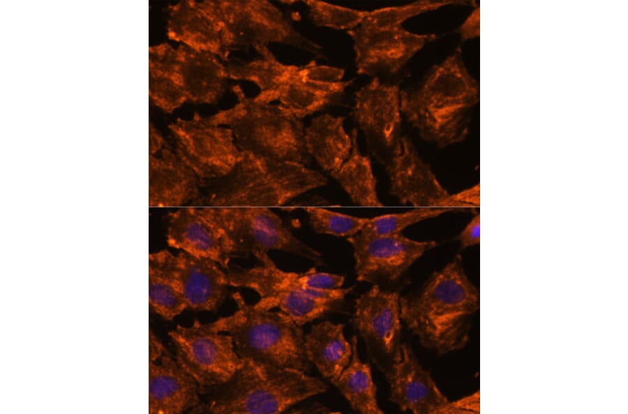 Immunofluorescence - Anti-Intersectin-2 Antibody (A88560) - Antibodies.com