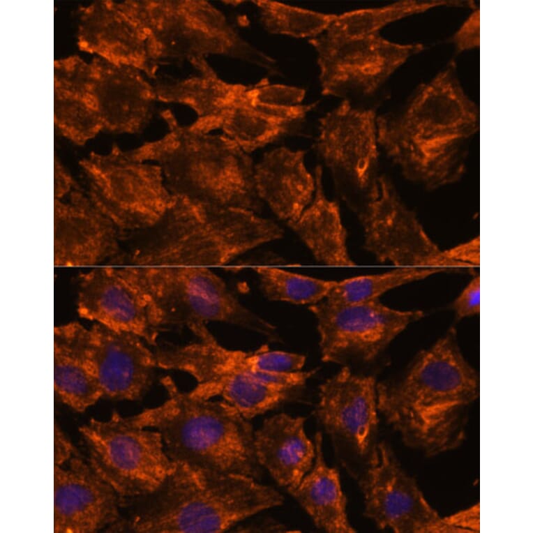 Immunofluorescence - Anti-Intersectin-2 Antibody (A88560) - Antibodies.com