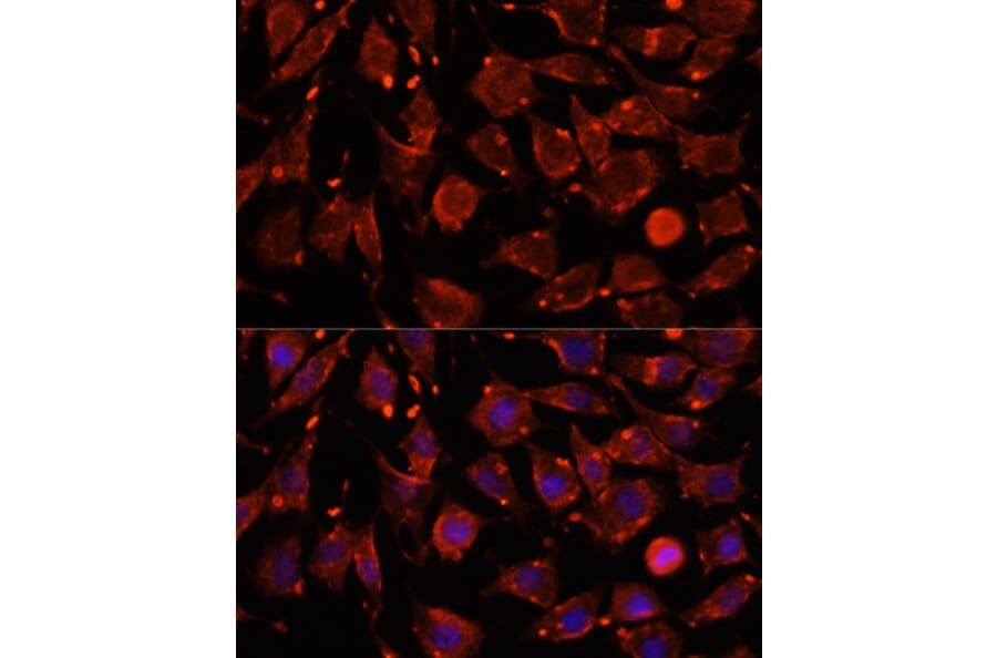 Immunofluorescence - Anti-Intersectin-2 Antibody (A88560) - Antibodies.com