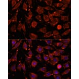 Immunofluorescence - Anti-Intersectin-2 Antibody (A88560) - Antibodies.com