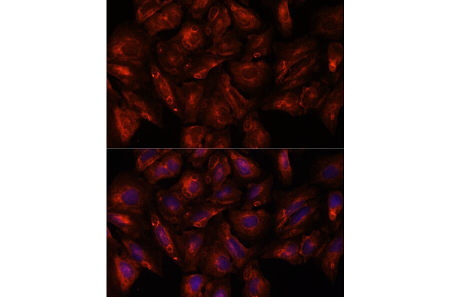 Immunofluorescence - Anti-Intersectin-2 Antibody (A88560) - Antibodies.com