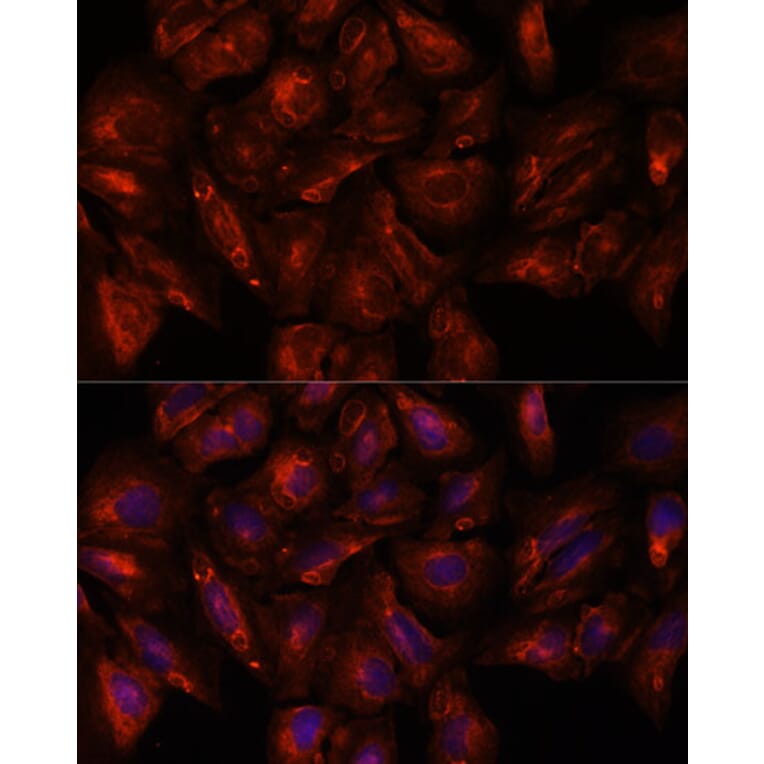 Immunofluorescence - Anti-Intersectin-2 Antibody (A88560) - Antibodies.com