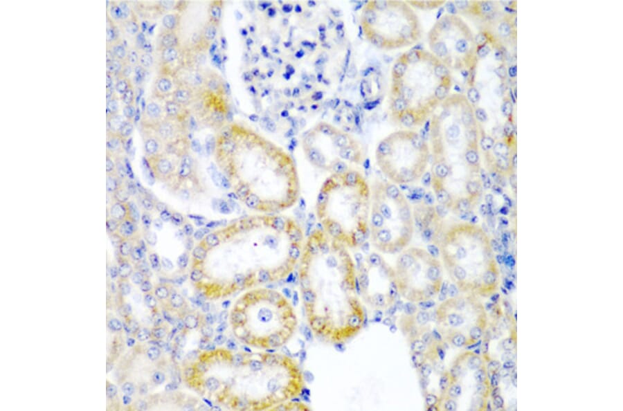 Immunohistochemistry - Anti-hUPF2/RENT2 Antibody (A88562) - Antibodies.com