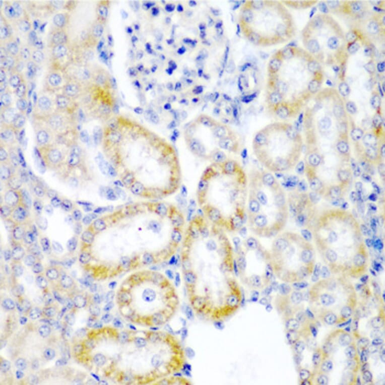 Immunohistochemistry - Anti-hUPF2/RENT2 Antibody (A88562) - Antibodies.com