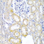 Immunohistochemistry - Anti-hUPF2/RENT2 Antibody (A88562) - Antibodies.com
