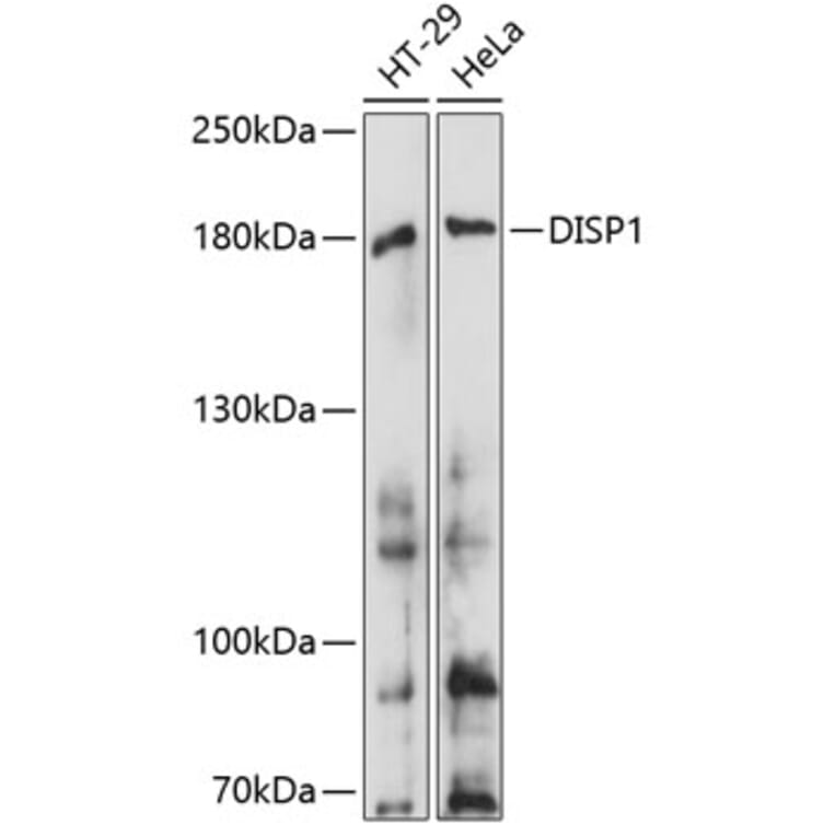 Western Blot - Anti-Dispatched Antibody (A88563) - Antibodies.com