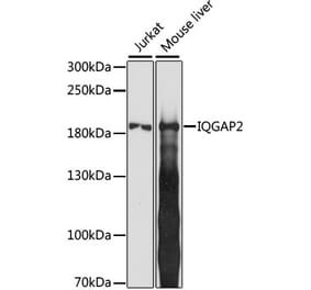 Western Blot - Anti-IQGAP2 Antibody (A88564) - Antibodies.com