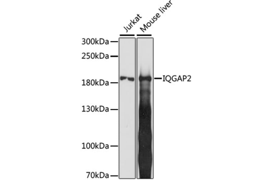 Western Blot - Anti-IQGAP2 Antibody (A88564) - Antibodies.com