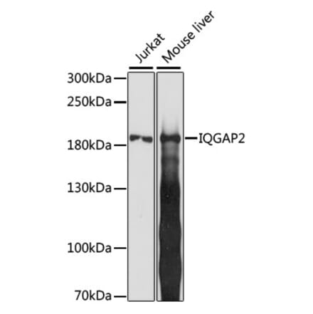 Western Blot - Anti-IQGAP2 Antibody (A88564) - Antibodies.com