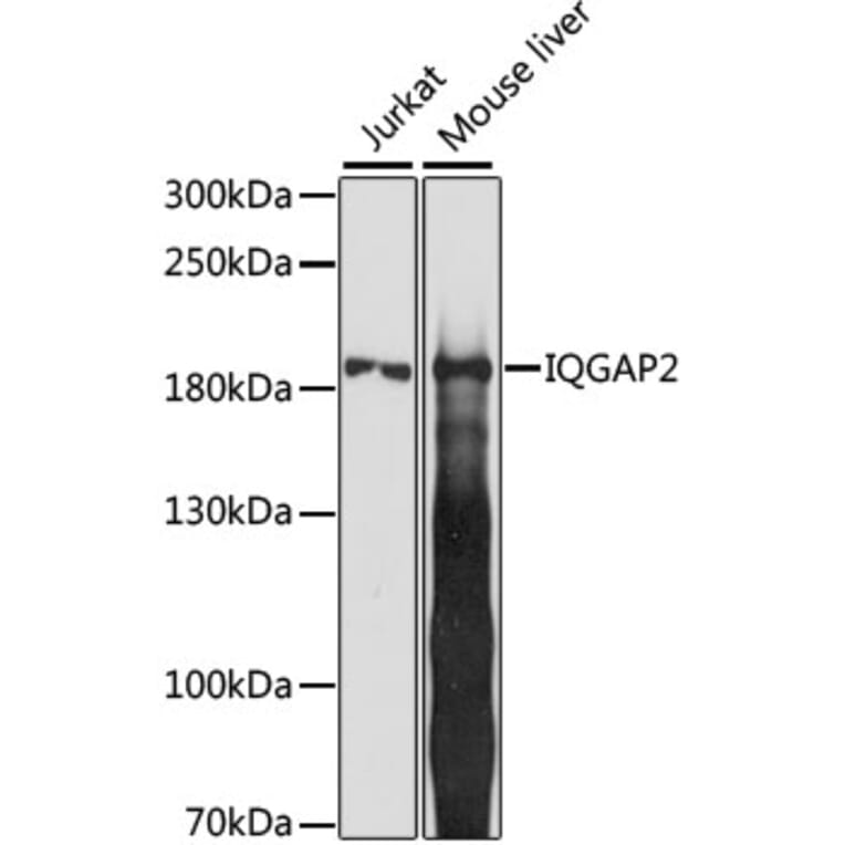 Western Blot - Anti-IQGAP2 Antibody (A88564) - Antibodies.com