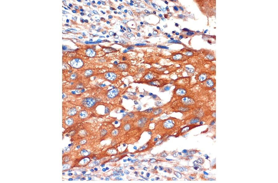 Immunohistochemistry - Anti-IQGAP2 Antibody (A88564) - Antibodies.com