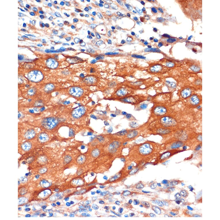 Immunohistochemistry - Anti-IQGAP2 Antibody (A88564) - Antibodies.com