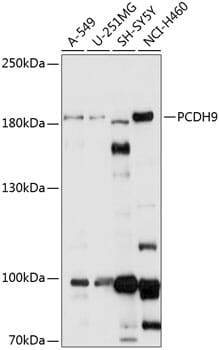 Western blot analysis of extracts of various cell lines, using Anti-PCDH9 Antibody (A14760) at 1:1,000 dilution.
Secondary antibody: Goat Anti-Rabbit IgG (H+L) (HRP) (AS014) at 1:10,000 dilution.
Lysates / proteins: 25µg per lane.
Blocking buffer: 3% non-fat dry milk in TBST.
Detection: ECL Basic Kit (RM00020).
Exposure time: 30s.