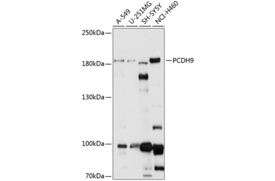 Western Blot - Anti-PCDH9 Antibody (A88565) - Antibodies.com