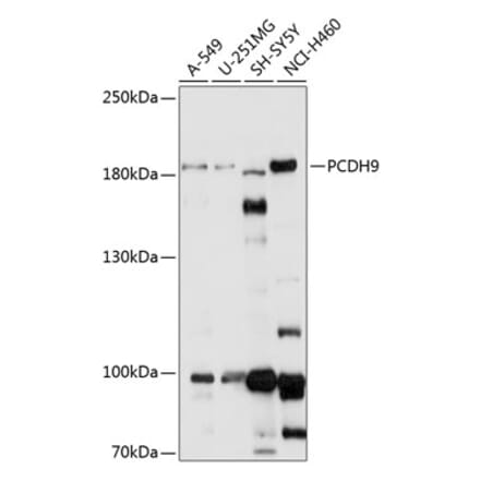 Western Blot - Anti-PCDH9 Antibody (A88565) - Antibodies.com