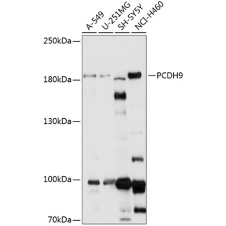 Western Blot - Anti-PCDH9 Antibody (A88565) - Antibodies.com
