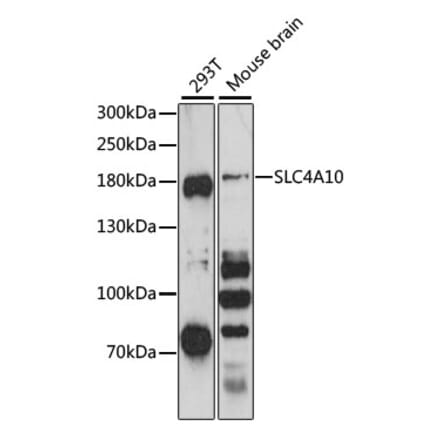 Western Blot - Anti-SLC4A10 Antibody (A88566) - Antibodies.com