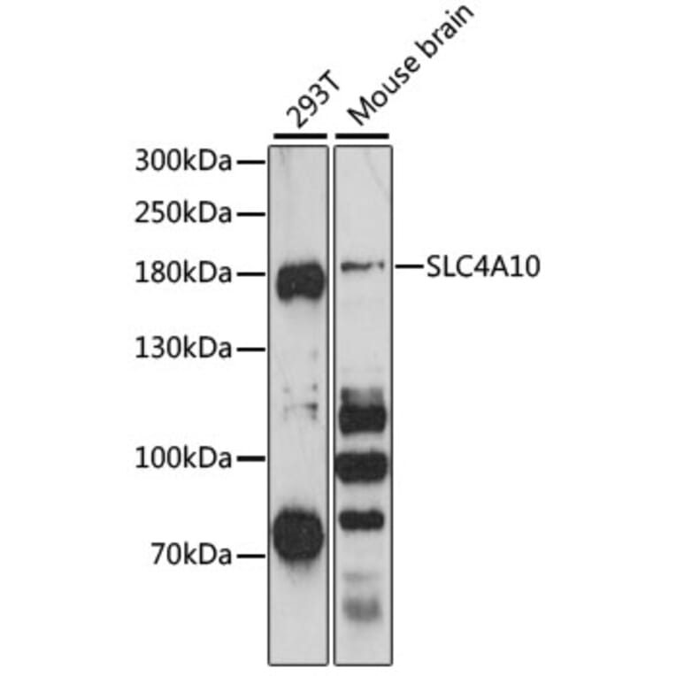 Western Blot - Anti-SLC4A10 Antibody (A88566) - Antibodies.com