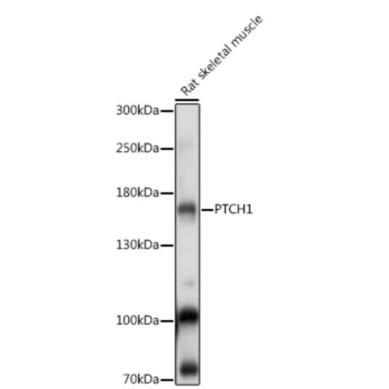 Western Blot - Anti-Patched/PTCH1 Antibody (A88567) - Antibodies.com