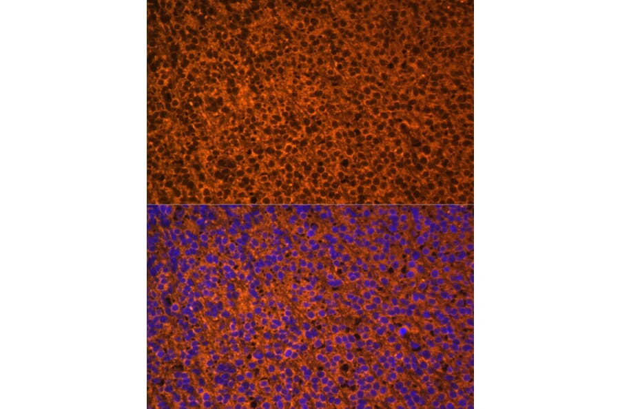 Immunofluorescence - Anti-Patched/PTCH1 Antibody (A88567) - Antibodies.com