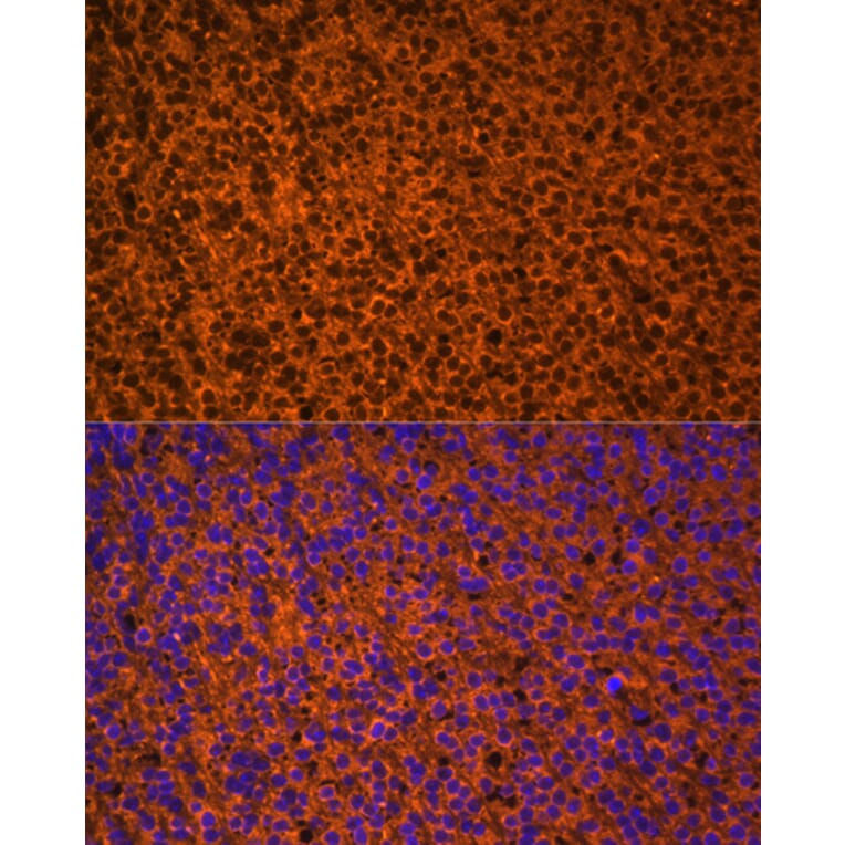 Immunofluorescence - Anti-Patched/PTCH1 Antibody (A88567) - Antibodies.com