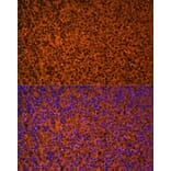 Immunofluorescence - Anti-Patched/PTCH1 Antibody (A88567) - Antibodies.com