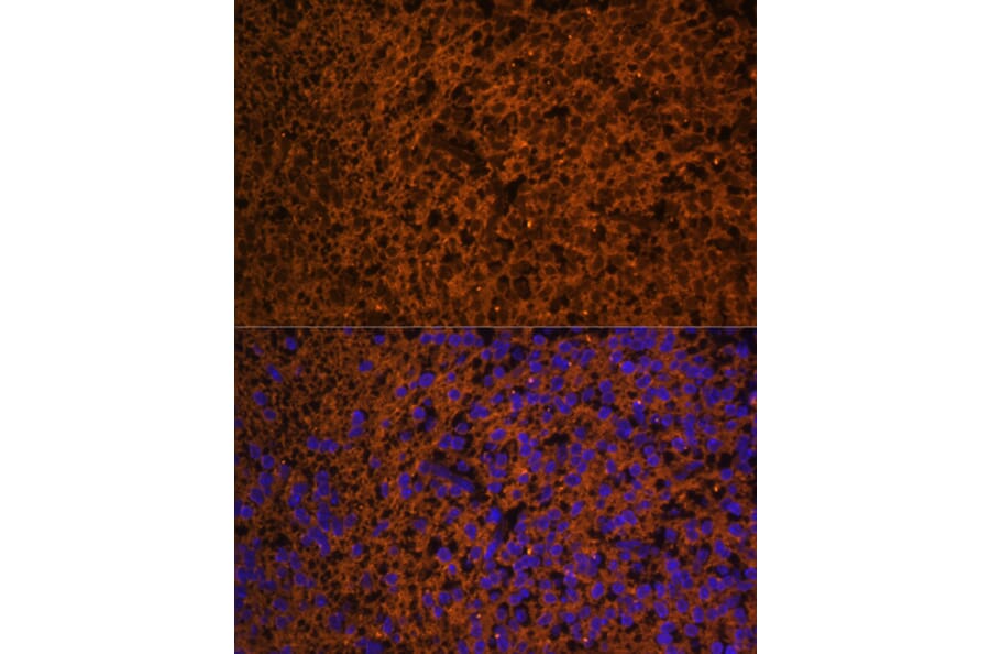 Immunofluorescence - Anti-Patched/PTCH1 Antibody (A88567) - Antibodies.com