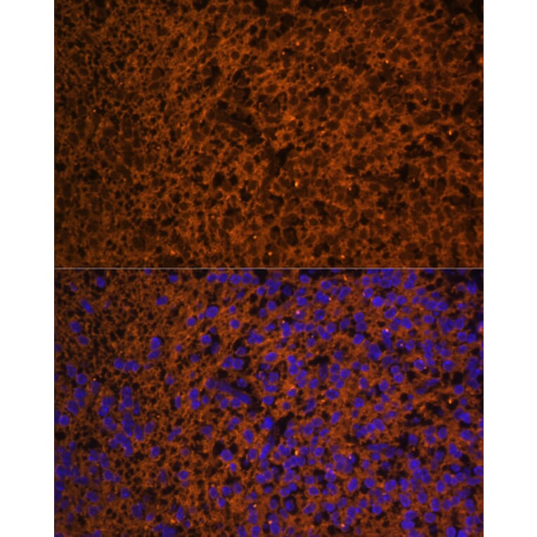 Immunofluorescence - Anti-Patched/PTCH1 Antibody (A88567) - Antibodies.com