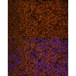 Immunofluorescence - Anti-Patched/PTCH1 Antibody (A88567) - Antibodies.com