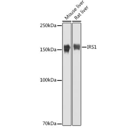 Western Blot - Anti-IRS1 Antibody (A88568) - Antibodies.com