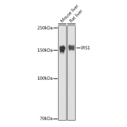 Western Blot - Anti-IRS1 Antibody (A88568) - Antibodies.com