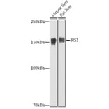 Western Blot - Anti-IRS1 Antibody (A88568) - Antibodies.com