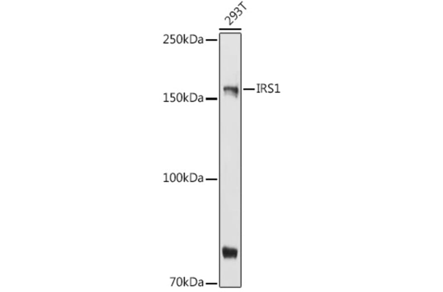 Western Blot - Anti-IRS1 Antibody (A88568) - Antibodies.com