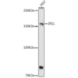 Western Blot - Anti-IRS1 Antibody (A88568) - Antibodies.com