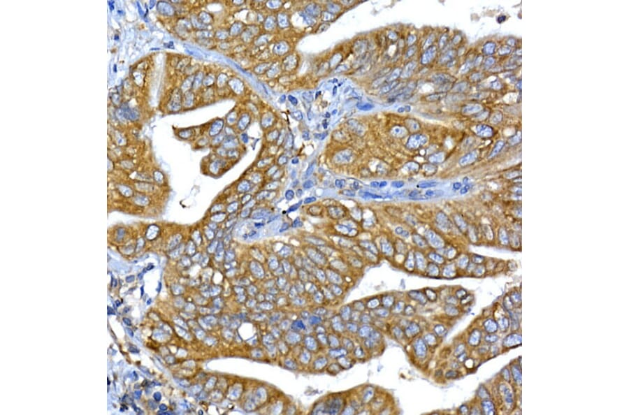 Immunohistochemistry - Anti-IRS1 Antibody (A88568) - Antibodies.com