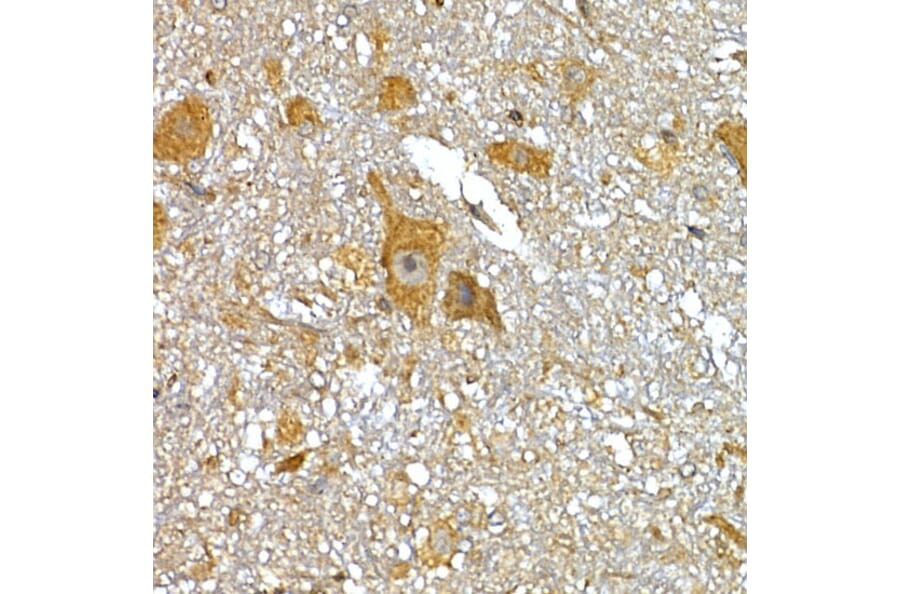 Immunohistochemistry - Anti-IRS1 Antibody (A88568) - Antibodies.com