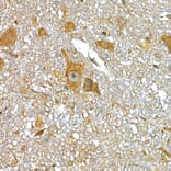 Immunohistochemistry - Anti-IRS1 Antibody (A88568) - Antibodies.com