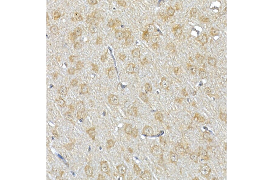 Immunohistochemistry - Anti-IRS1 Antibody (A88568) - Antibodies.com