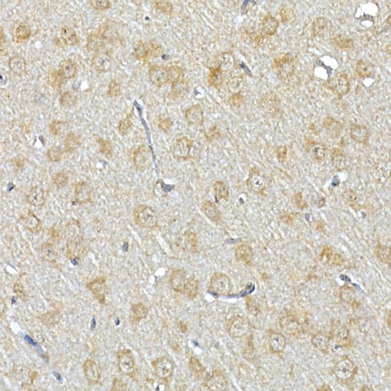 Immunohistochemistry - Anti-IRS1 Antibody (A88568) - Antibodies.com