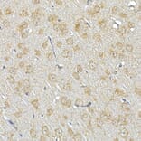 Immunohistochemistry - Anti-IRS1 Antibody (A88568) - Antibodies.com