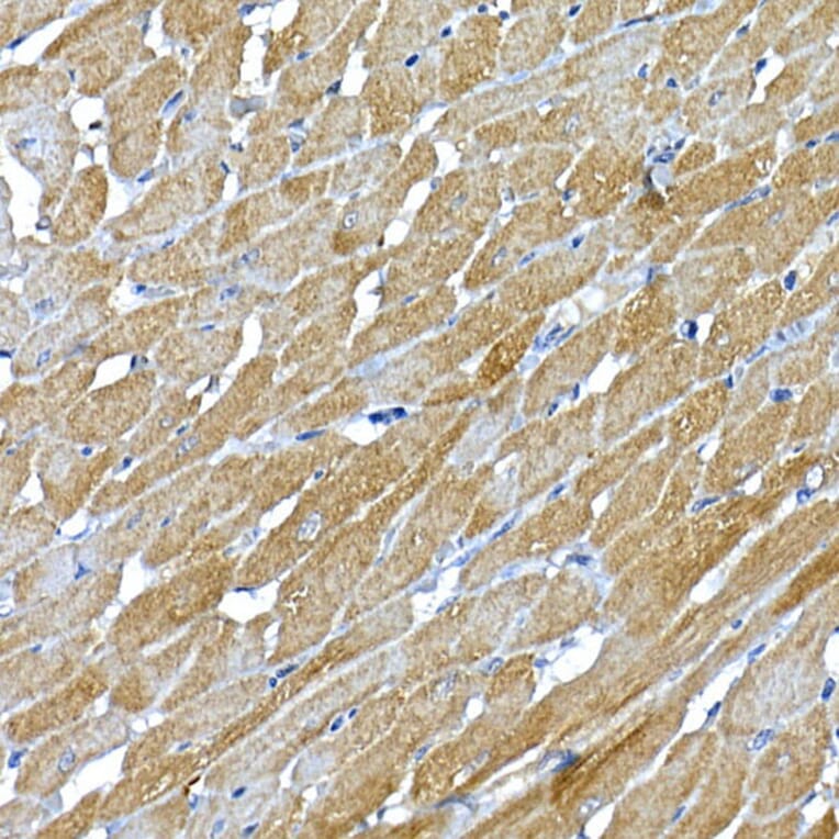 Immunohistochemistry - Anti-IRS1 Antibody (A88568) - Antibodies.com