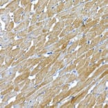 Immunohistochemistry - Anti-IRS1 Antibody (A88568) - Antibodies.com