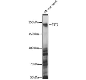 Western Blot - Anti-Tet2 Antibody (A88569) - Antibodies.com