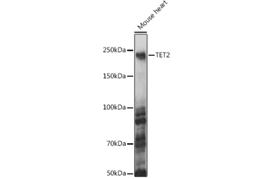 Western Blot - Anti-Tet2 Antibody (A88569) - Antibodies.com